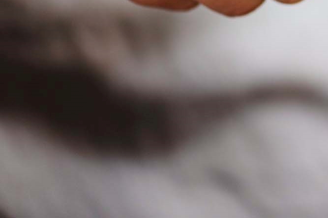 신경치료 후 크라운 꼭 해야되는 이유 관련 이미지 26