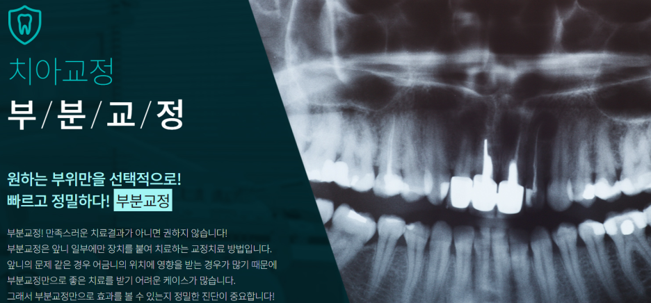 서초동 구강교정 치과 바른 치아 배열을 위해 관련 이미지 9