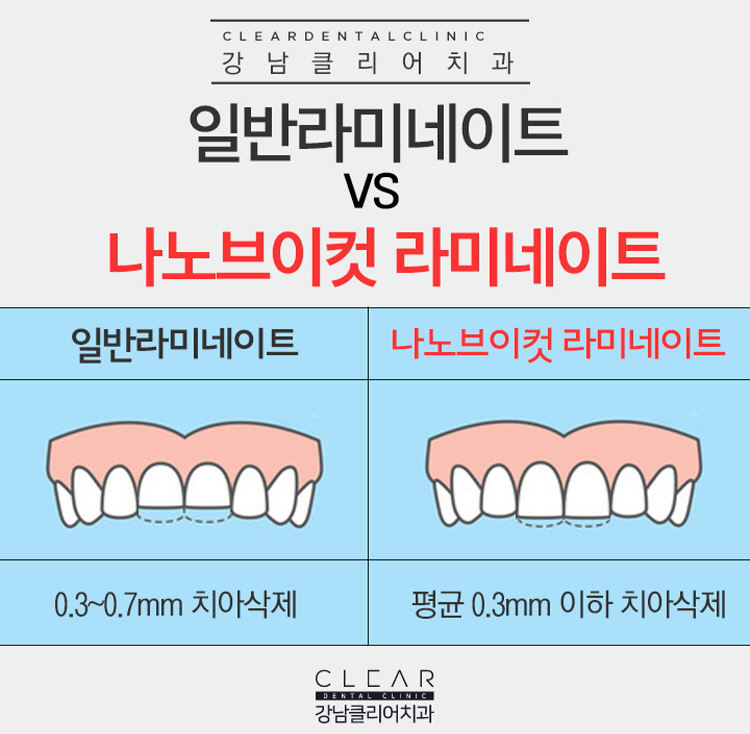 강남라미네이트 앞뒤옆까지 확실하게하자! 관련 이미지 6