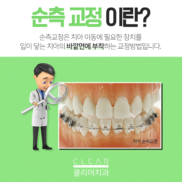 들어와봐~ 너에게만 비밀스런교정방법 알려줄게! 관련 이미지 4