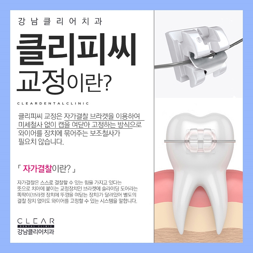 클리어치과 클리피씨 이 곳에서 한다면? 관련 이미지 2