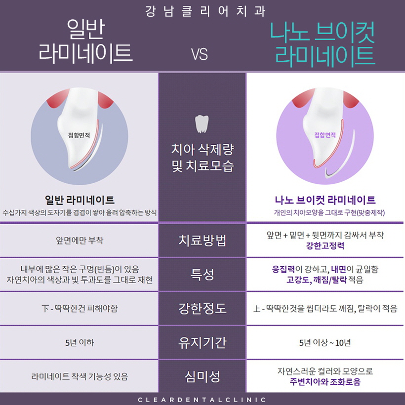 강남역 라미네이트 잘하는 치과 간단하고 효과적인 치료 관련 이미지 3