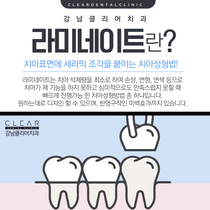 강남역라미네이트 완벽맞춤 나노브이컷 라미네이트 관련 이미지 3