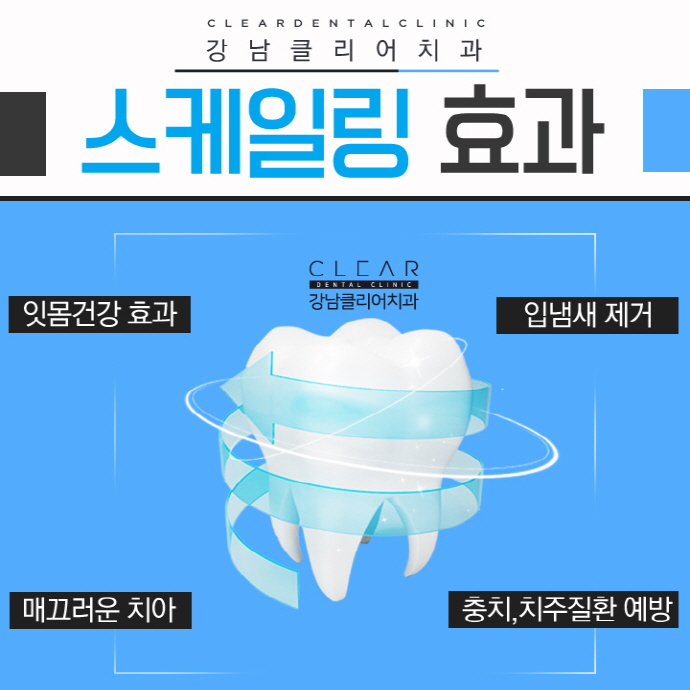 치아 스케일링 하는 이유, 효과, 주의사항 관련 이미지 4