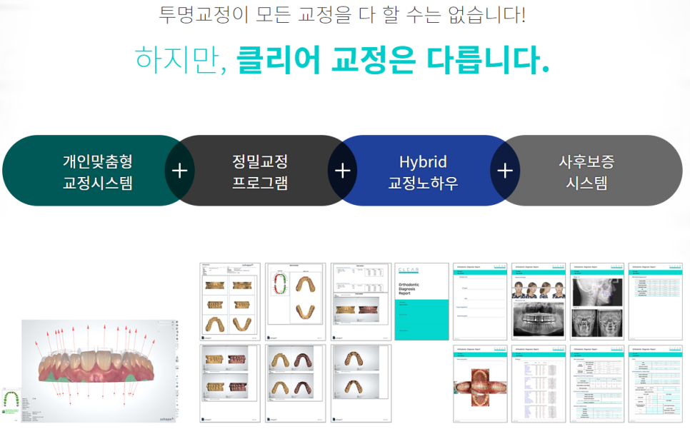 강남역 교정치과 치아배열이 콤플렉스라면 관련 이미지 8