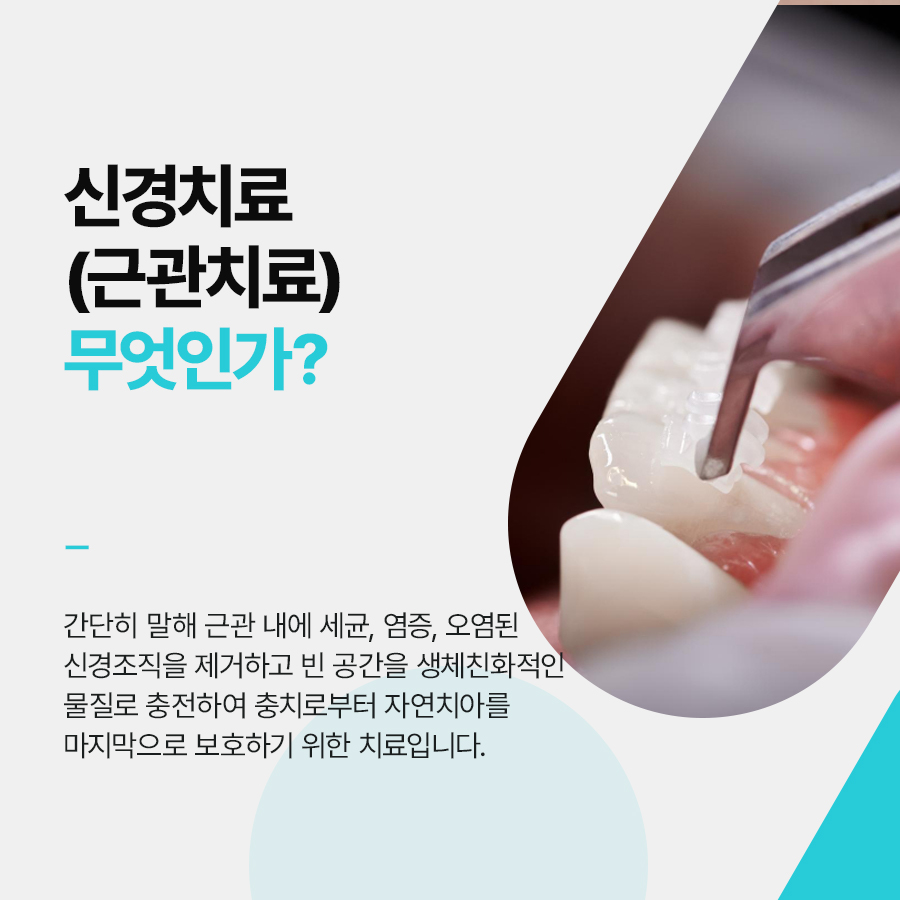 강남클리어치과 신경치료 필요할때 증상 기간은? 관련 이미지 2