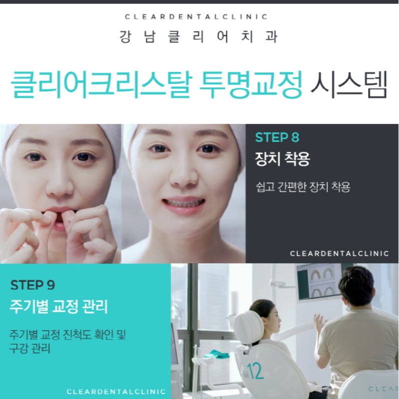 강남역투명교정 자연스러운미소를 가져보세요! 관련 이미지 12