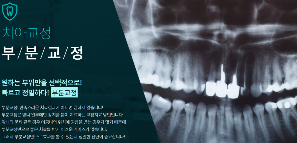 반포동치아교정 반듯한 치아를 갖고 싶다면 관련 이미지 9