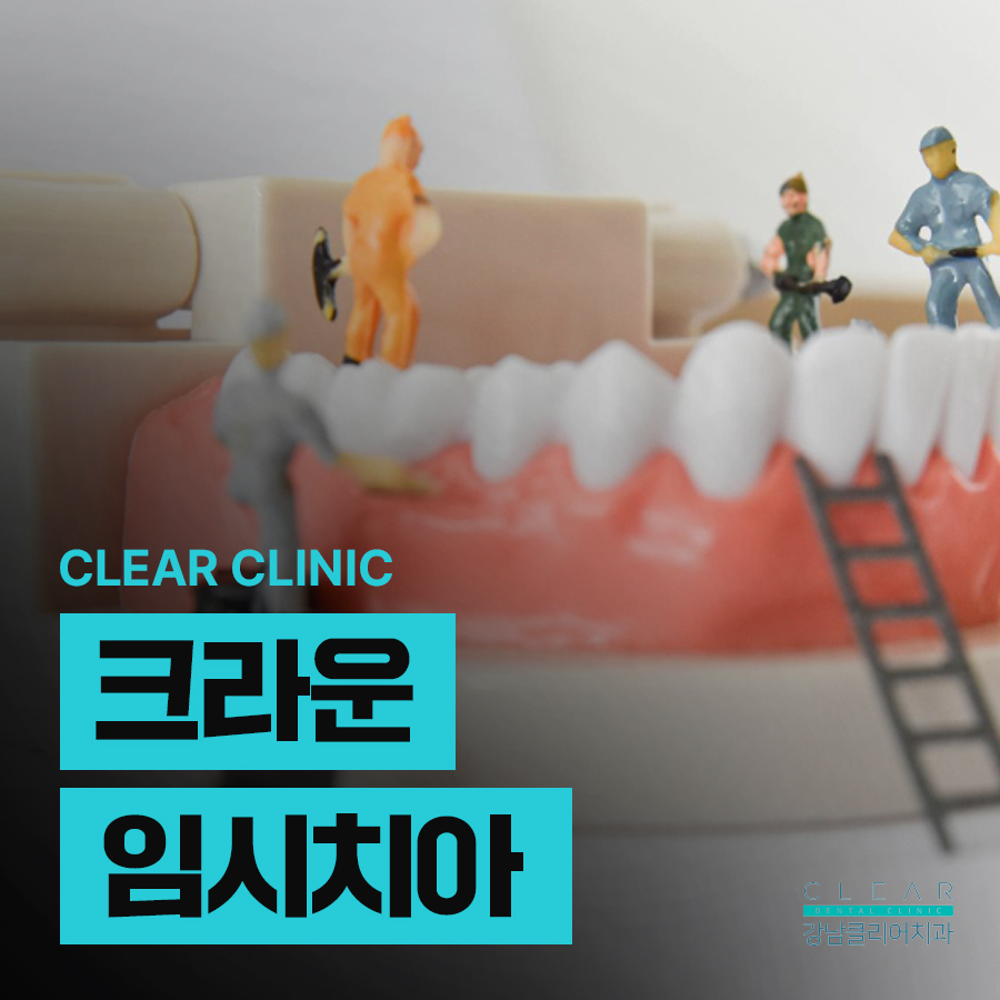 크라운 임시치아 내 치아처럼 다듬어서 관련 이미지 1