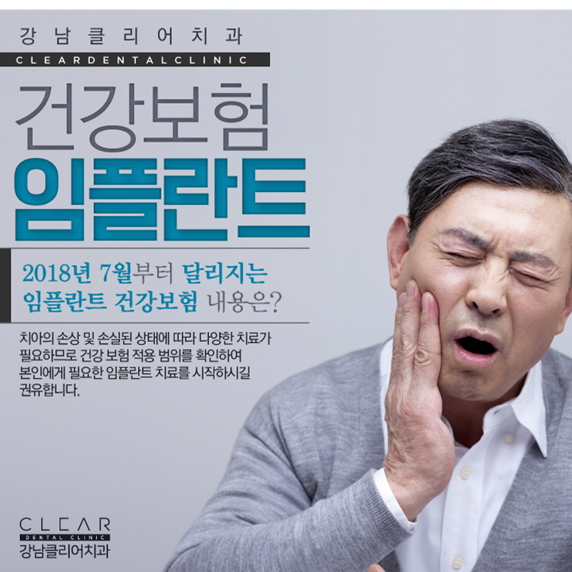 65세이상임플란트 가격 건강보험 적용여부 확인 관련 이미지 1