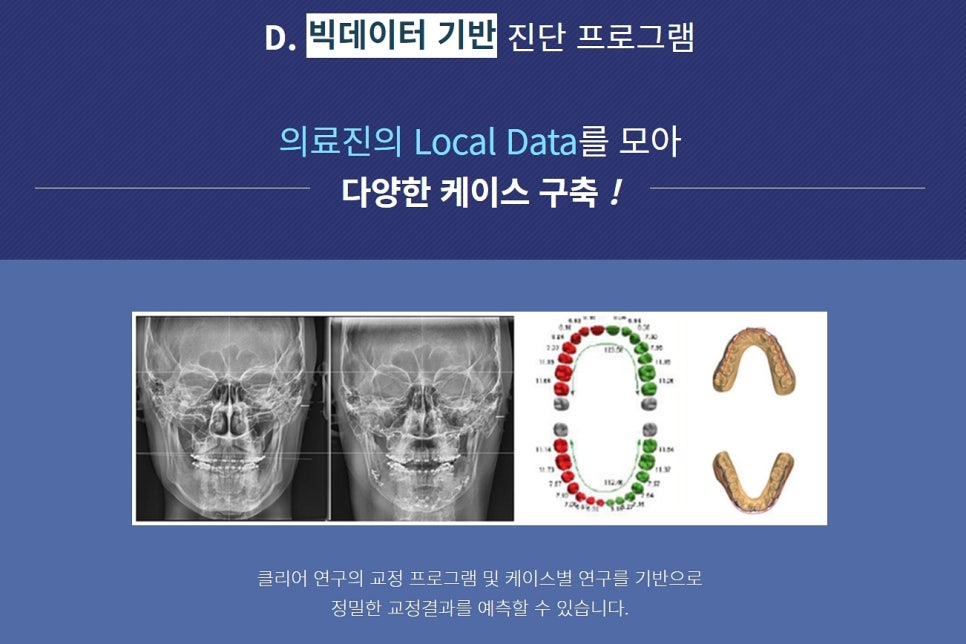 강남클리어치과 교정 종류가 궁금해 관련 이미지 5