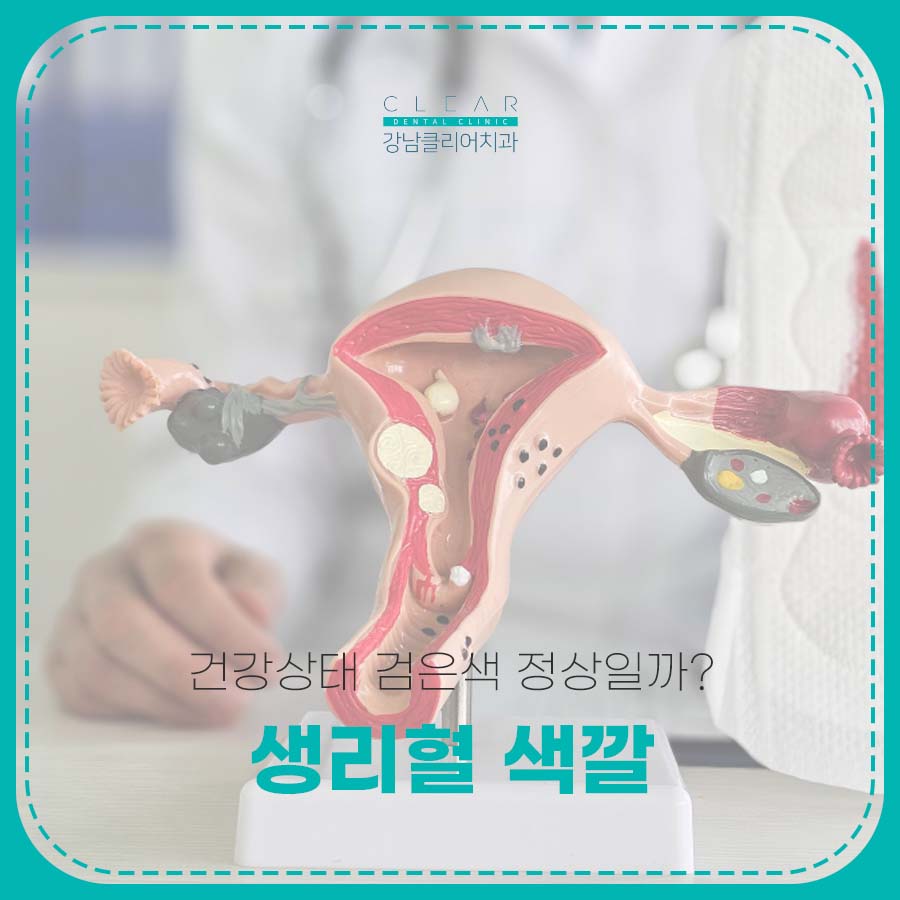 생리혈 색깔로 보는 건강상태 검은색 정상일까? 관련 이미지 1