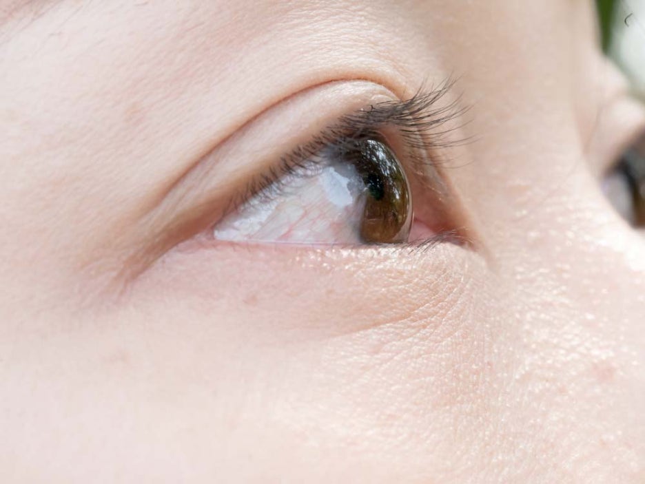 다래끼 나는 이유 전염여부 빨리 낫는법 관련 이미지 2