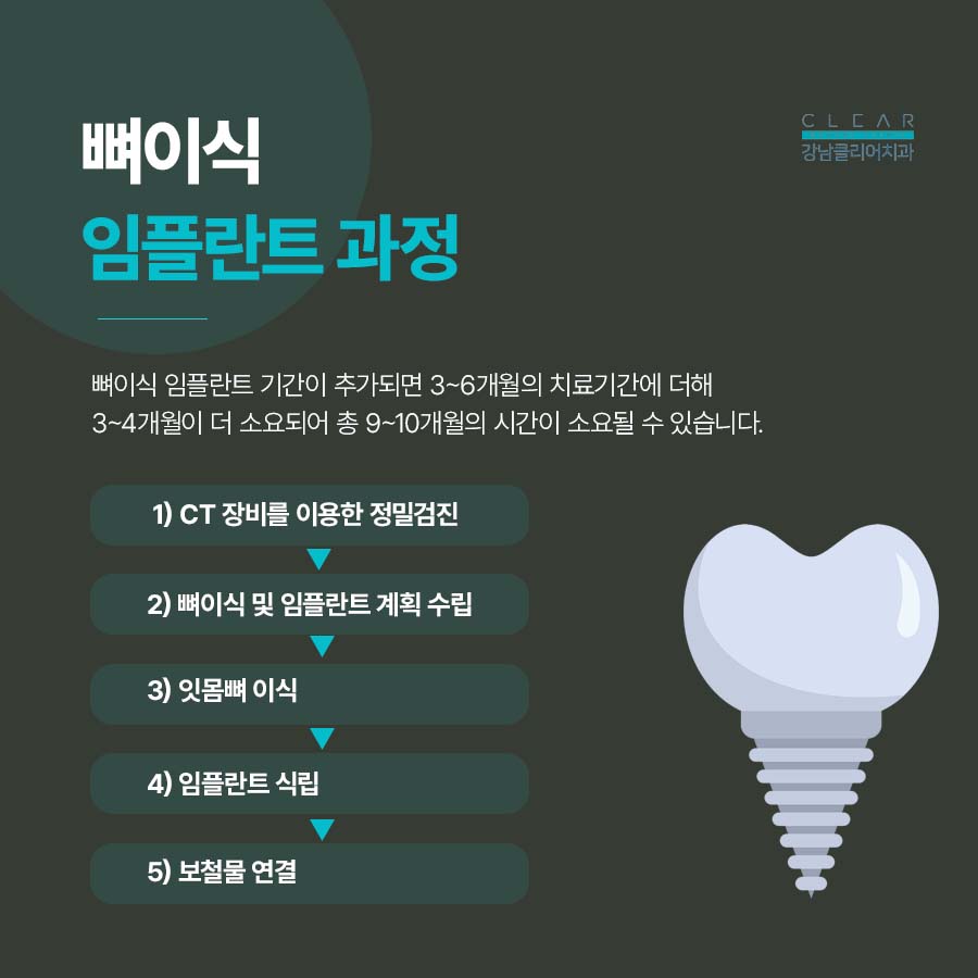 치과 뼈이식 임플란트 기간 과정 주의사항은? 관련 이미지 4
