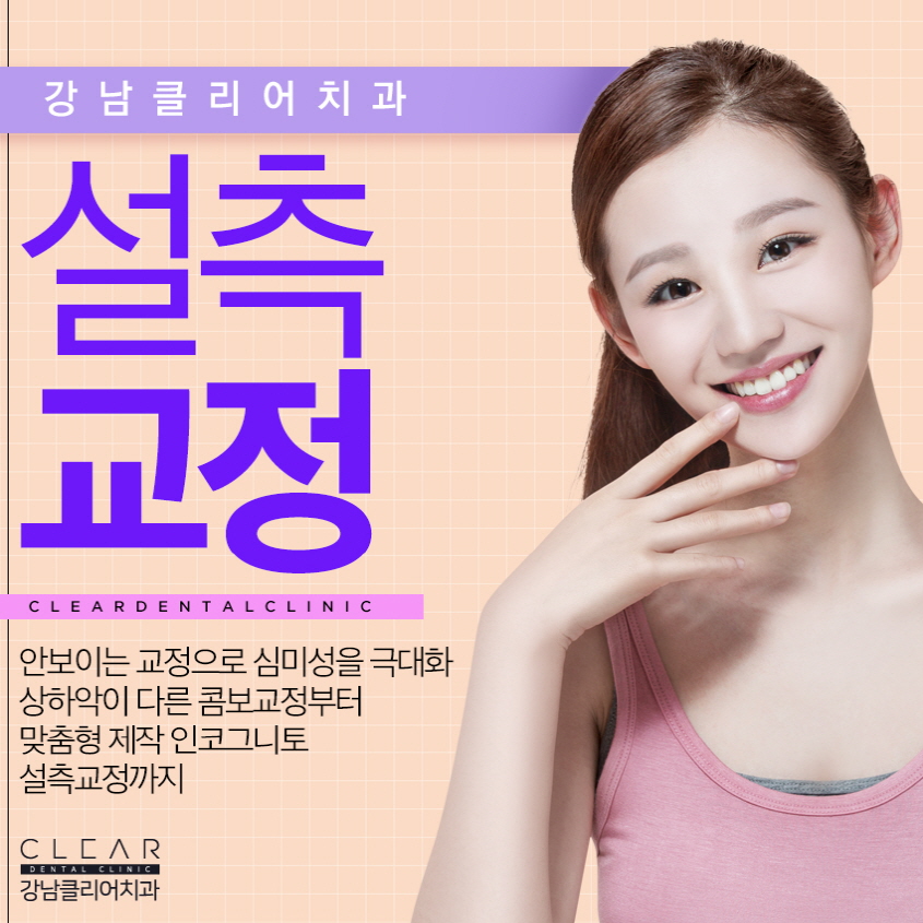 설측교정 교정한거 아무도 몰라요 관련 이미지 1
