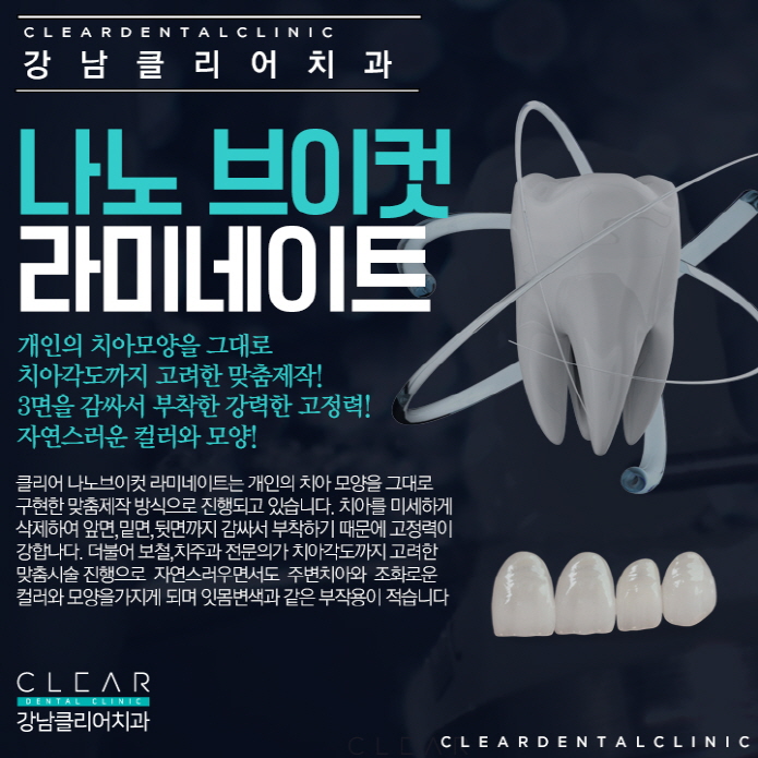 강남역라미네이트 완벽맞춤 나노브이컷 라미네이트 관련 이미지 5