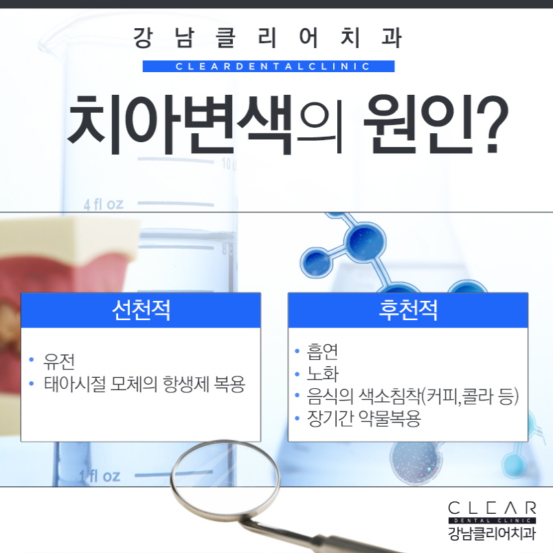 강남역 치과 치아미백 어떻게 다른걸까? 관련 이미지 3
