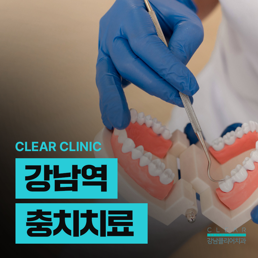 강남역 충치치료 인레이 크라운 차이 비교 관련 이미지 1