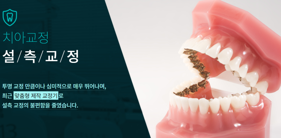 강남설측교정 꼼꼼한 진료를 해주는 곳을 찾는다면 관련 이미지 2
