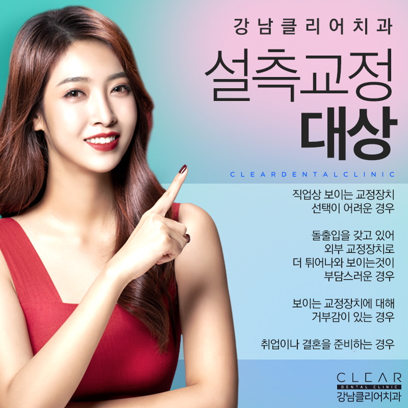 설측교정 교정한거 아무도 몰라요 관련 이미지 4