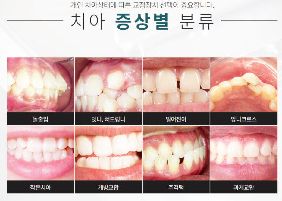 클리어치과 케이스에 따른 섬세한 케어를 하는 곳 관련 이미지 2