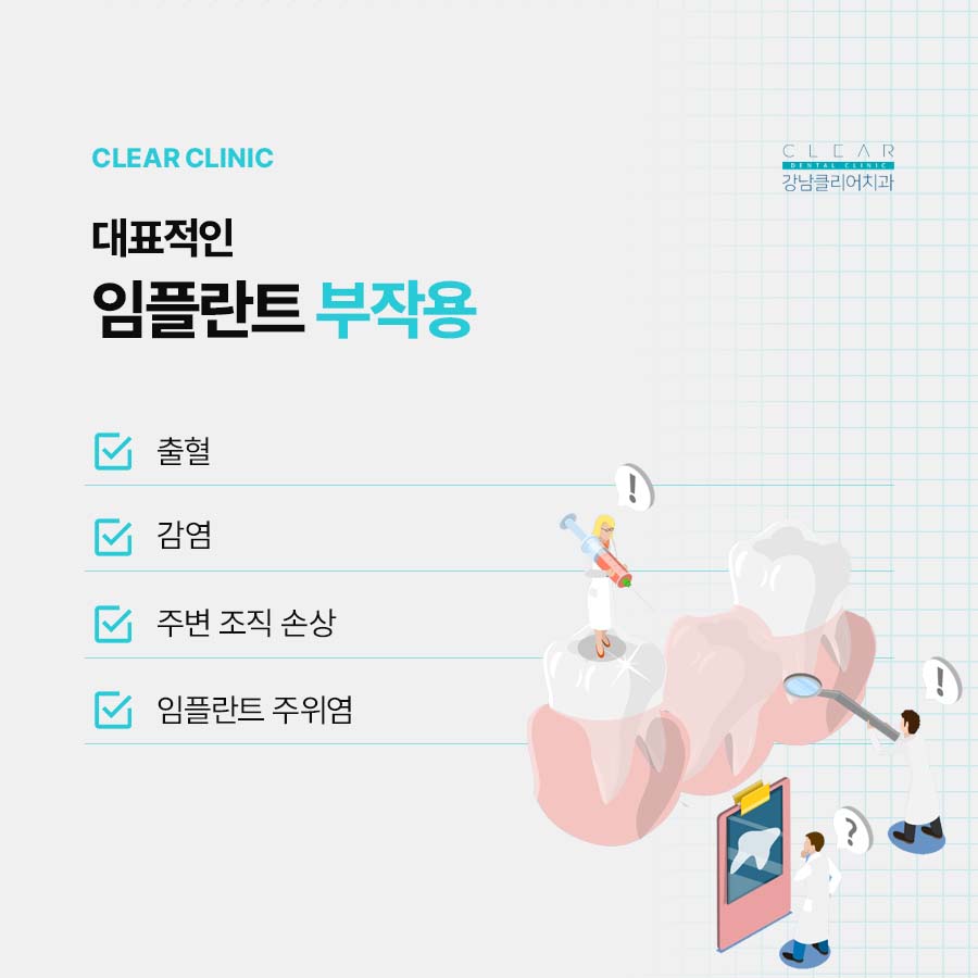 서초역 임플란트 부작용을 피하려면 관련 이미지 2