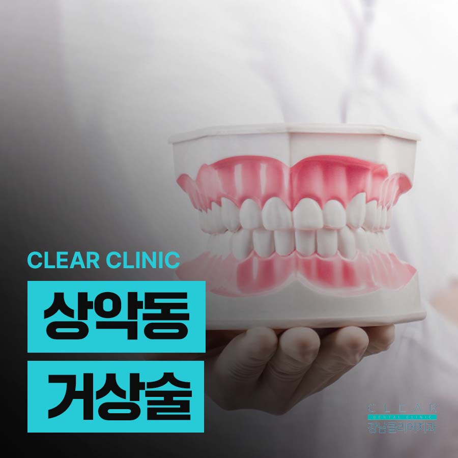 상악동거상술 주의사항 필요한 경우 정리 관련 이미지 1