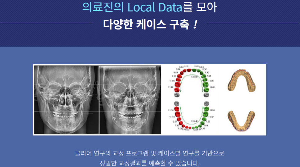 서초동치아교정치과 치열을 보기 좋게 관련 이미지 3