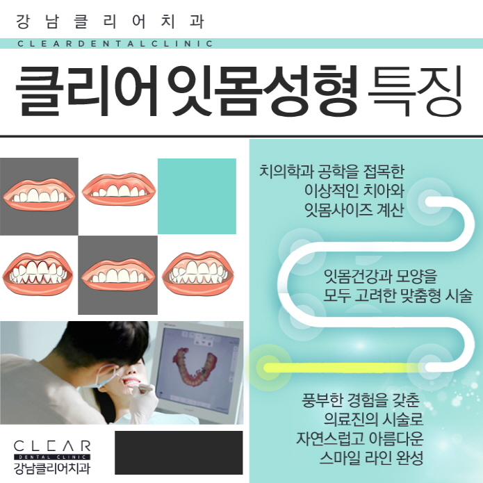 연예인잇몸성형, 잇몸성형 자신감 있는 미소 되찾기 관련 이미지 8