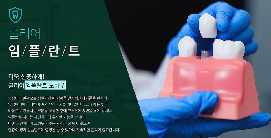서울 임플란트치과 어디로 가볼까 관련 이미지 3