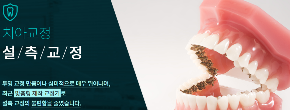 도곡동교정치과 반듯한 치아를 갖기 위한 준비 관련 이미지 5