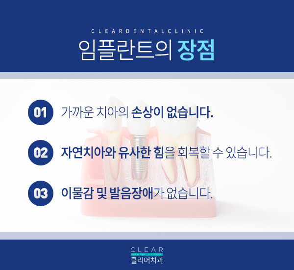 임플란트 궁금증 해결하러 왔어요~ 관련 이미지 4