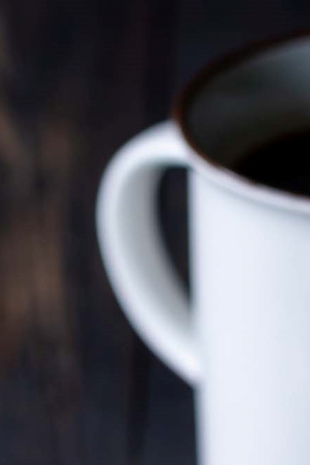 임플란트뼈이식수술 뼈이식 종류 주의사항은? 관련 이미지 21