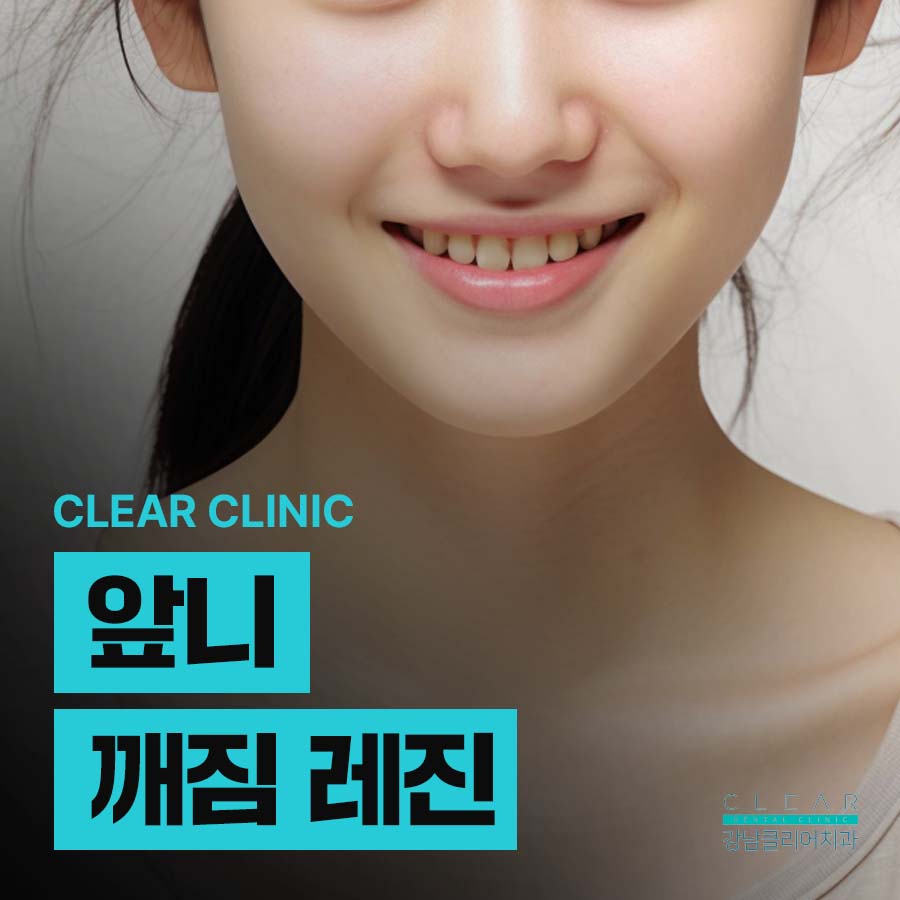 앞니 깨짐 레진 치료방법은? 관련 이미지 1