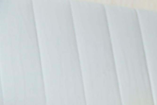 라미네이트 치아삭제 꼭 필요한 만큼만 해요 관련 이미지 15