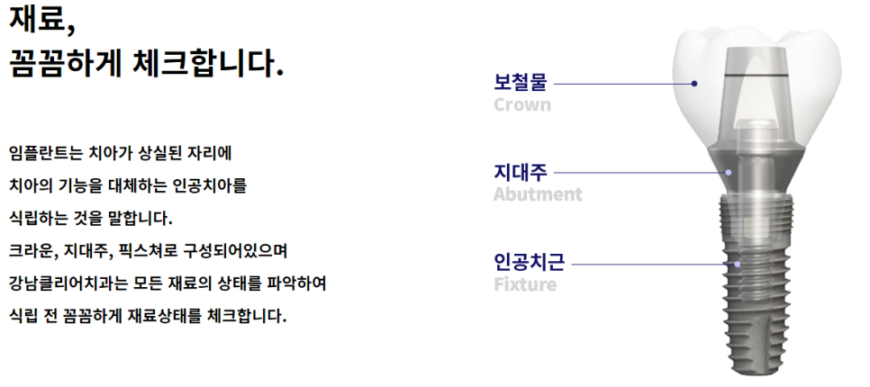 강남역임플란트치과 신중하게 선택해야 관련 이미지 3