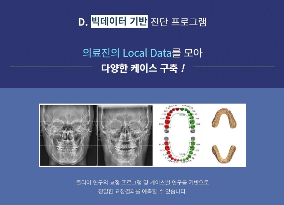클리어치과 클리피씨 이 곳에서 한다면? 관련 이미지 6