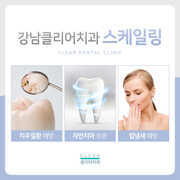 자연치아를 소중히 하기 위한, 스케일링 관련 이미지 5