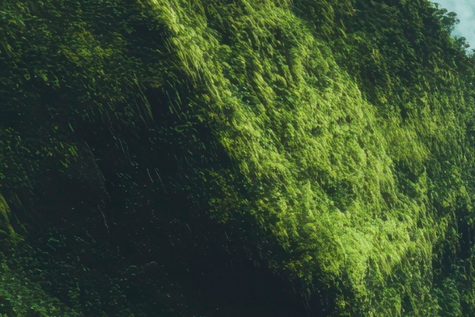 치아 사이 충치 조기에 발견해야 관련 이미지 26