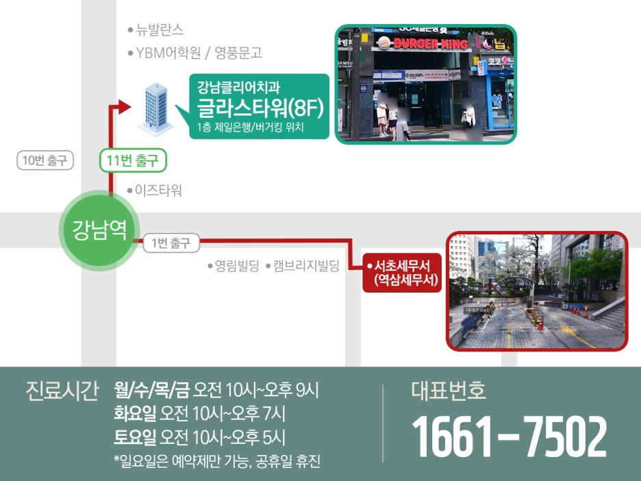 반포 레진 치료 강남클리어치과에서 편안하게 관련 이미지 16