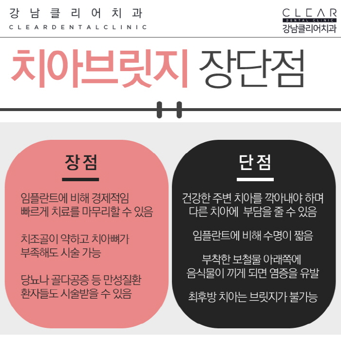 치아브릿지 강남치아브릿지도 이제 맞춤형으로 관련 이미지 5