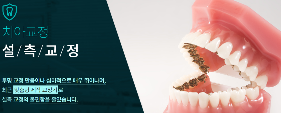 강남치아교정 배열이 신경쓰이는 경우라면? 관련 이미지 3