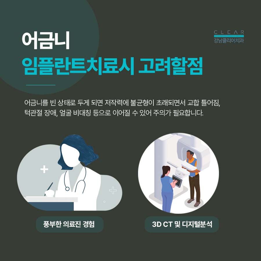 어금니임플란트치료 시 고려해야하는 점 관련 이미지 3