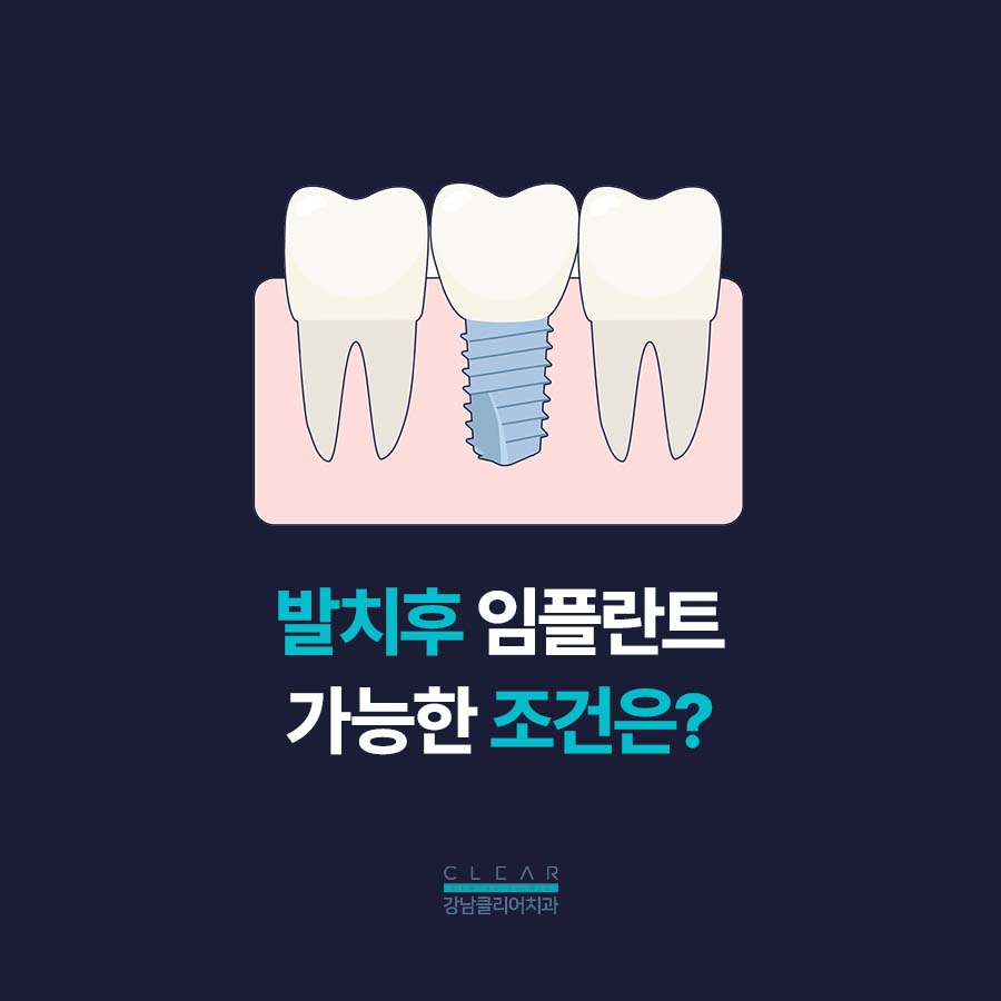 발치후 임플란트 가능한 조건은 무엇? 관련 이미지 2