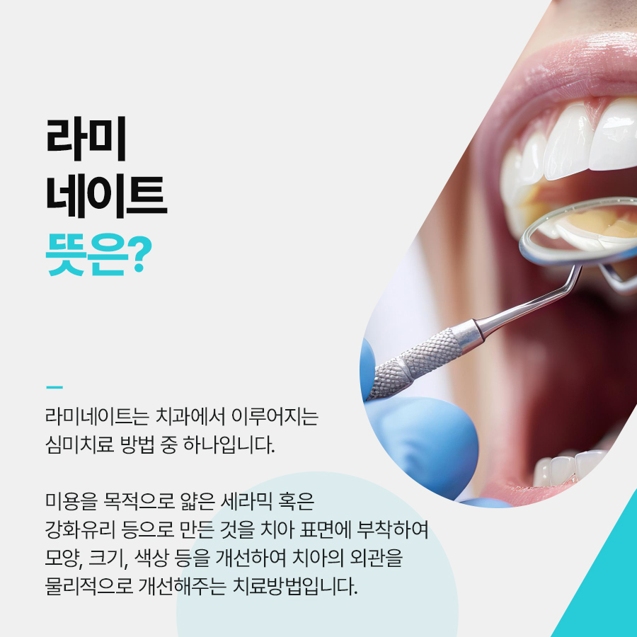 라미네이트 치아삭제 꼭 필요한 만큼만 해요 관련 이미지 2