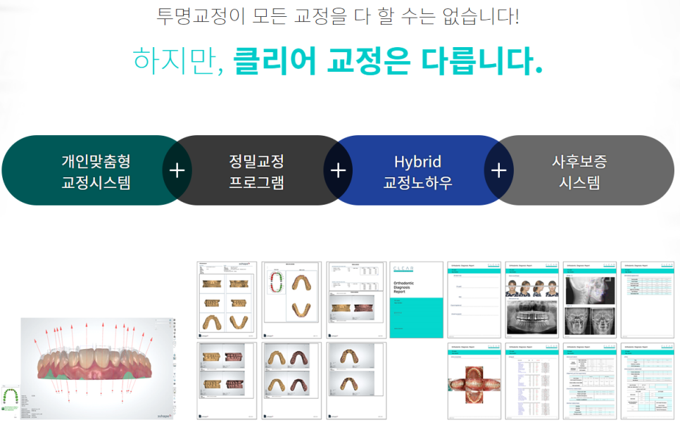 강남역치아교정치과 내 치아에 맞는 방법은? 관련 이미지 5