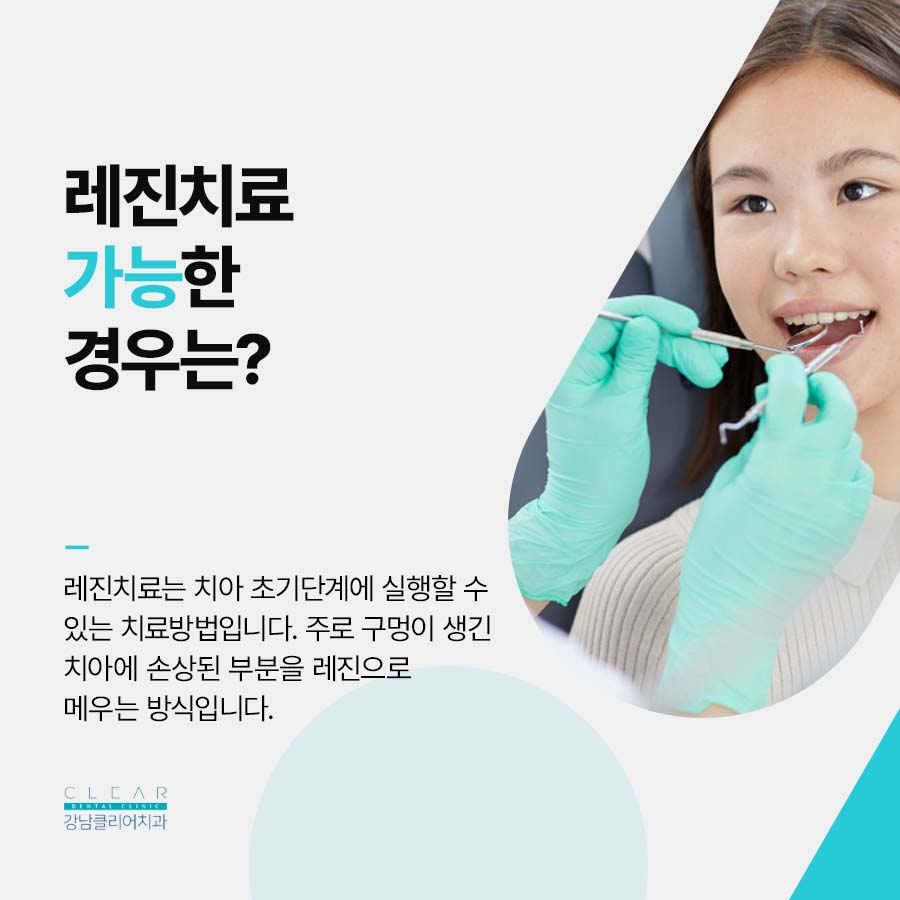 클리어치과 충치치료 어금니 레진이 가능한 경우 관련 이미지 4
