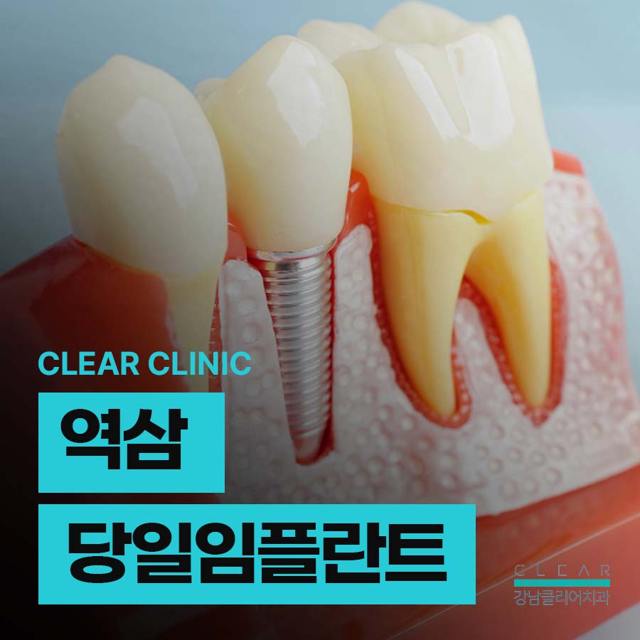 역삼 당일 임플란트 이러한 분들에게 좋아요 관련 이미지 1