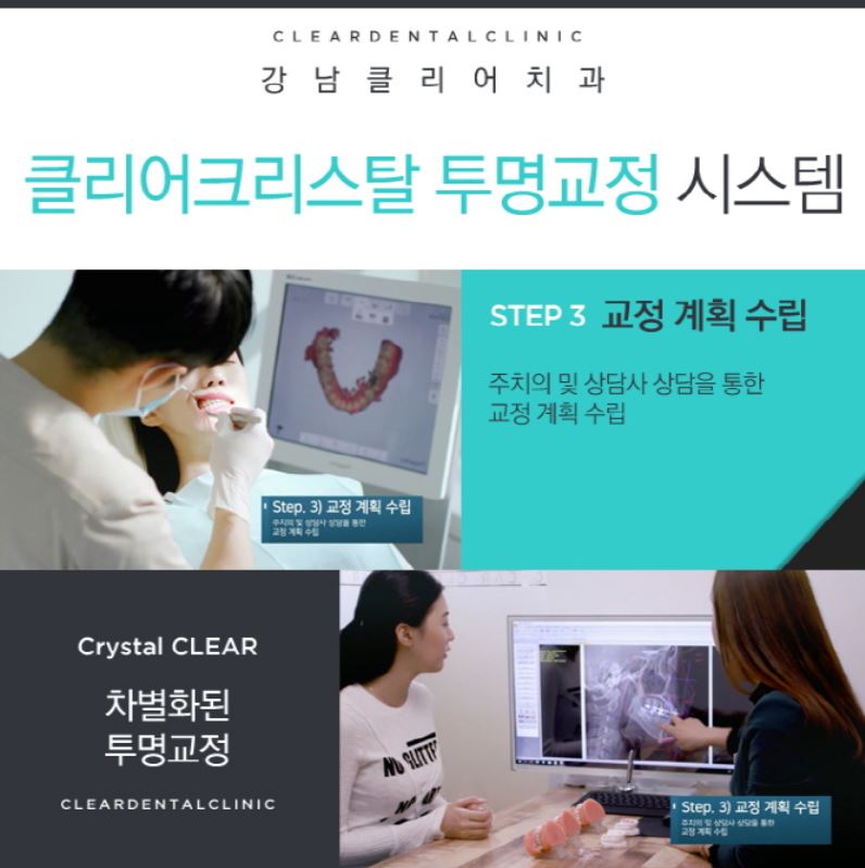 강남역투명교정 자연스러운미소를 가져보세요! 관련 이미지 7