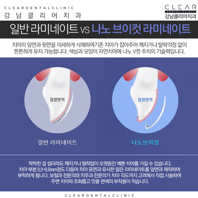 강남라미네이트 앞뒤옆까지 확실하게하자! 관련 이미지 5